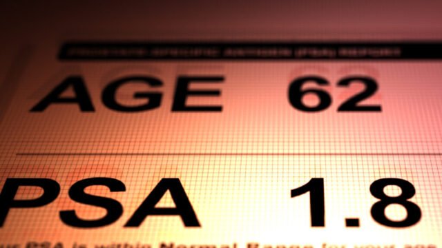 Opinia: Czy moje badania przesiewowe w kierunku raka prostaty przyniosły więcej szkody niż pożytku?
| przegladursynowski.pl