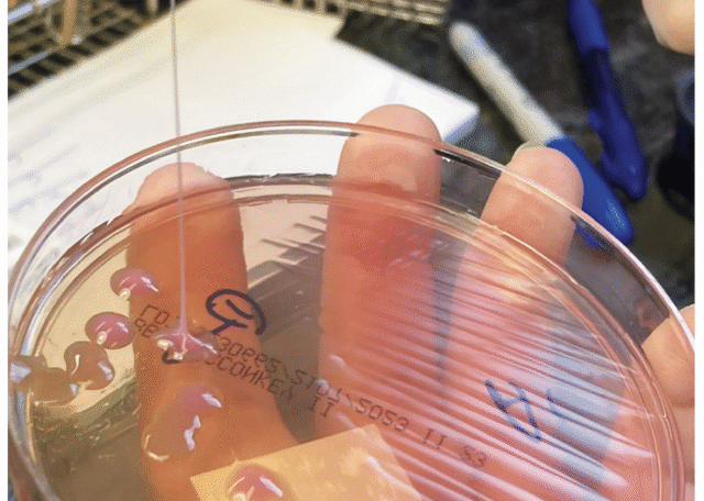 To może być najbardziej obrzydliwe zdjęcie oka w historii, ale przyczyna jest naprawdę przerażająca
| przegladursynowski.pl