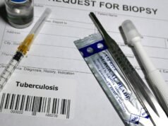 W 2025 r. Mizoram w wieku 145 lat odnotował najwyższy od sześciu lat wskaźnik zgonów na gruźlicę
| przegladursynowski.pl W 2025 r. Mizoram w wieku 145 lat odnotował najwyższy od sześciu lat wskaźnik zgonów na gruźlicę
| przegladursynowski.pl